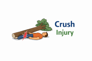 Crush injury under fallen tree